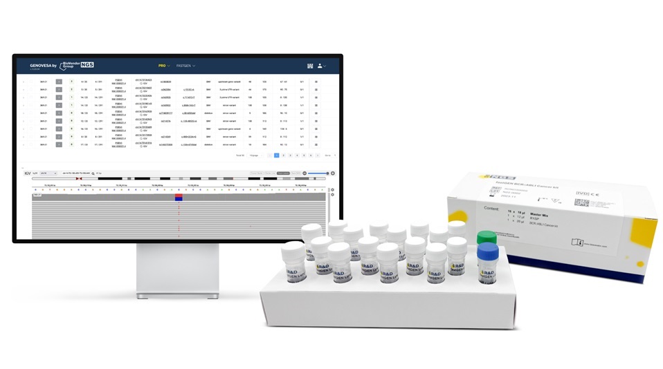 Imagen: El kit FastGen BCR :: ABL1 ofrece una forma de personalizar las estrategias de tratamiento para la leucemia (Foto cortesía del Biovendor MDX)